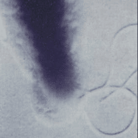 Bartonella batterio dei pappataci visto al microscopio